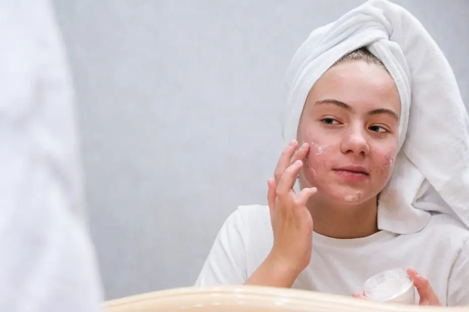 Acne blog Huidskills Kliniek