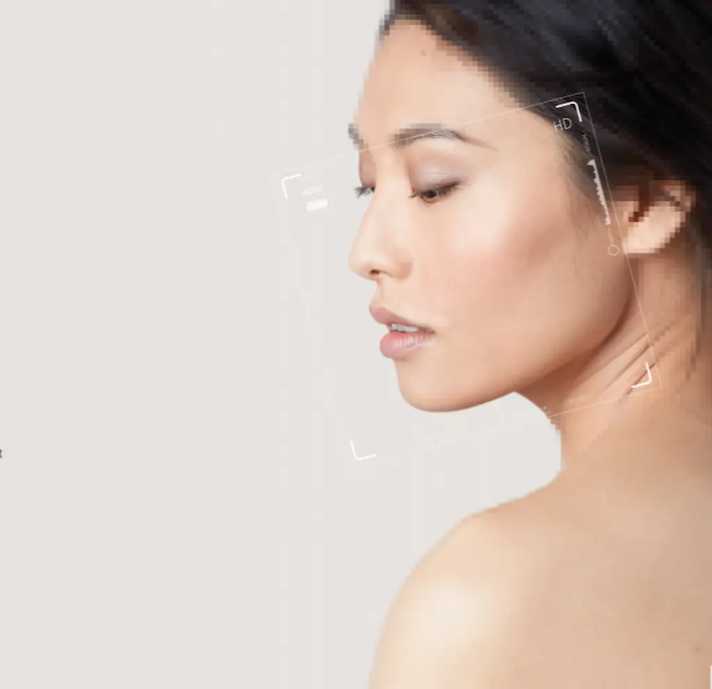 Microneedling Huidskills Kliniek