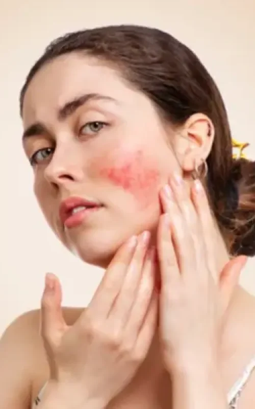 Wanneer de huid uit balans is